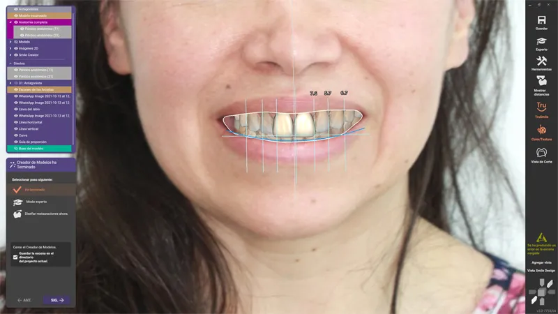 clínica dental en viña del mar diseño digital de sonrisa