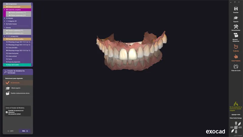clínica dental en viña del mar diseño digital de sonrisa